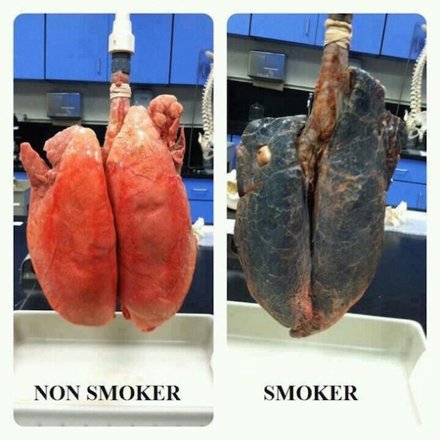 lungs