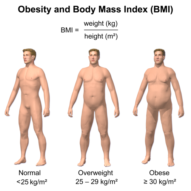 Obesity_&_BMI